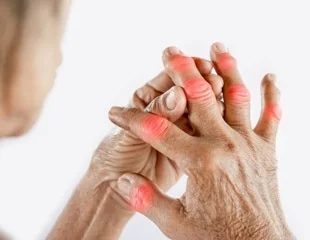 Homeopathic solutions for Orthopaedic Disorder